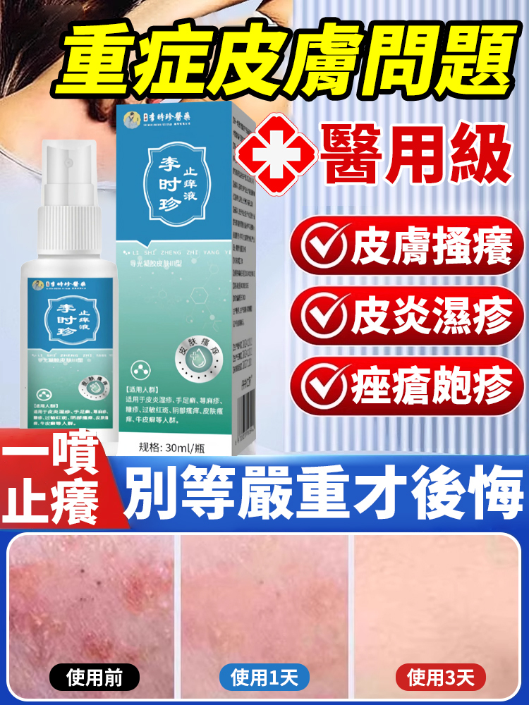 止癢液
