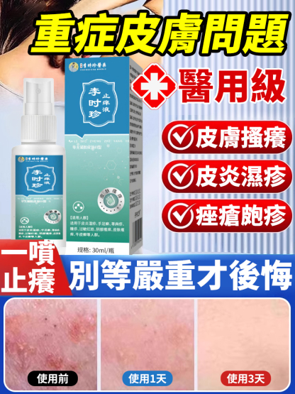 止癢液