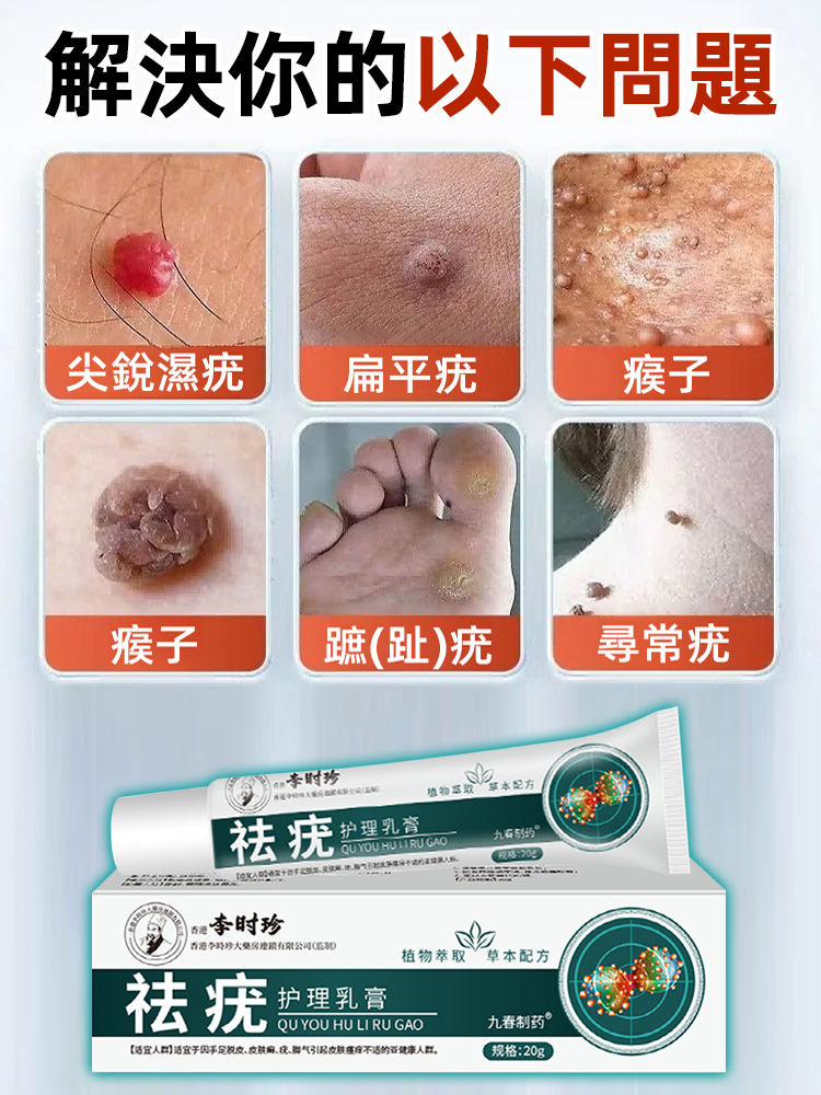 祛疣護理乳膏
