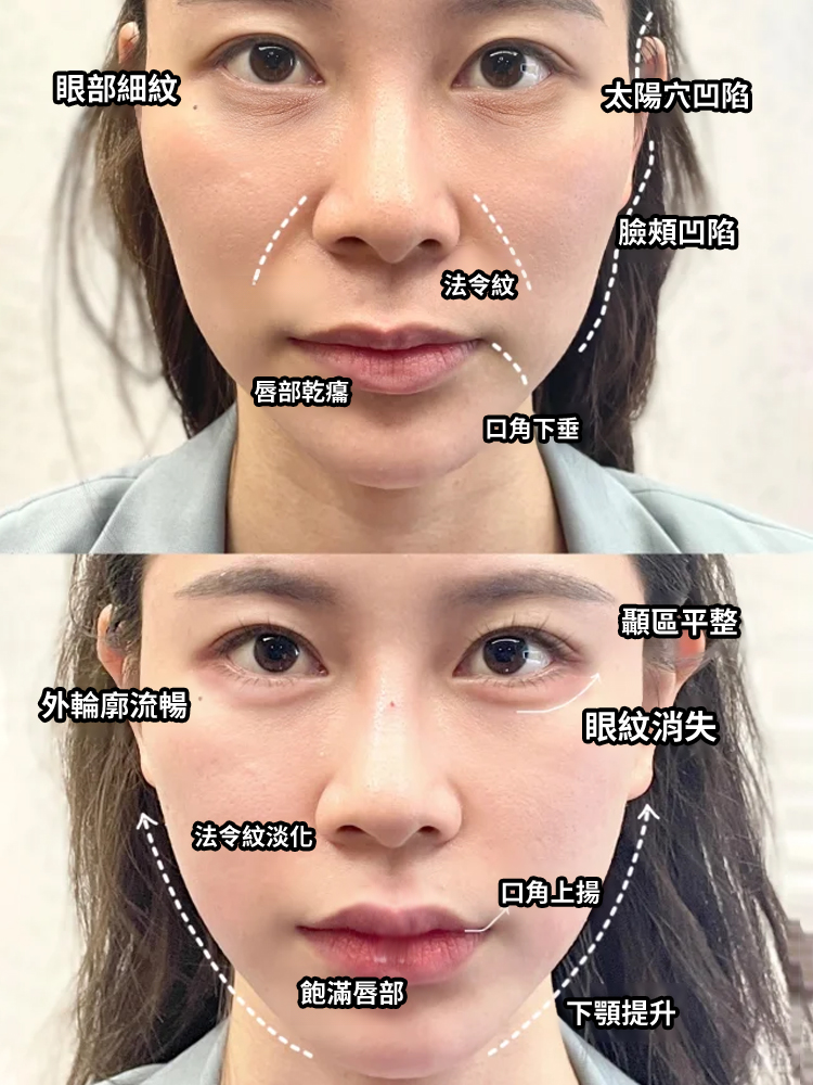 多勝肽緊緻淡紋精華棒