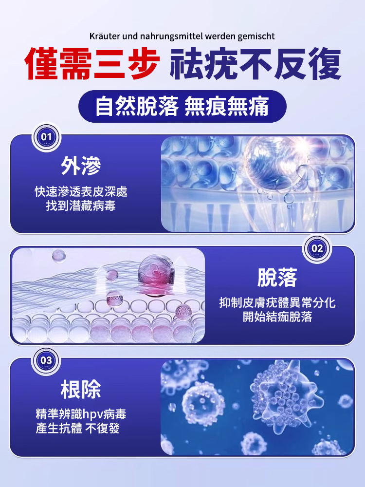妙古方疣瘊清抑菌液