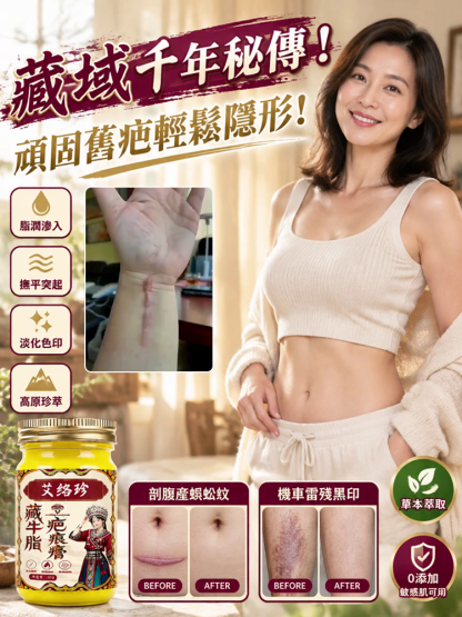 【藏域高原修復秘方】藏牛脂草本疤痕膏