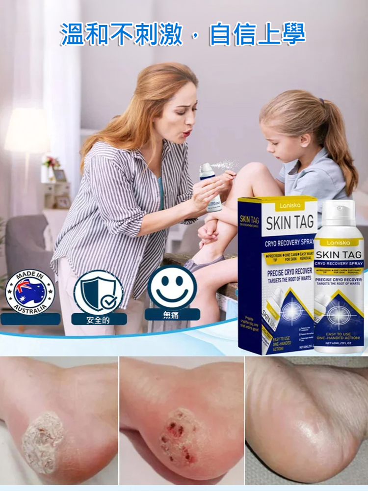 疣點外用護理噴霧