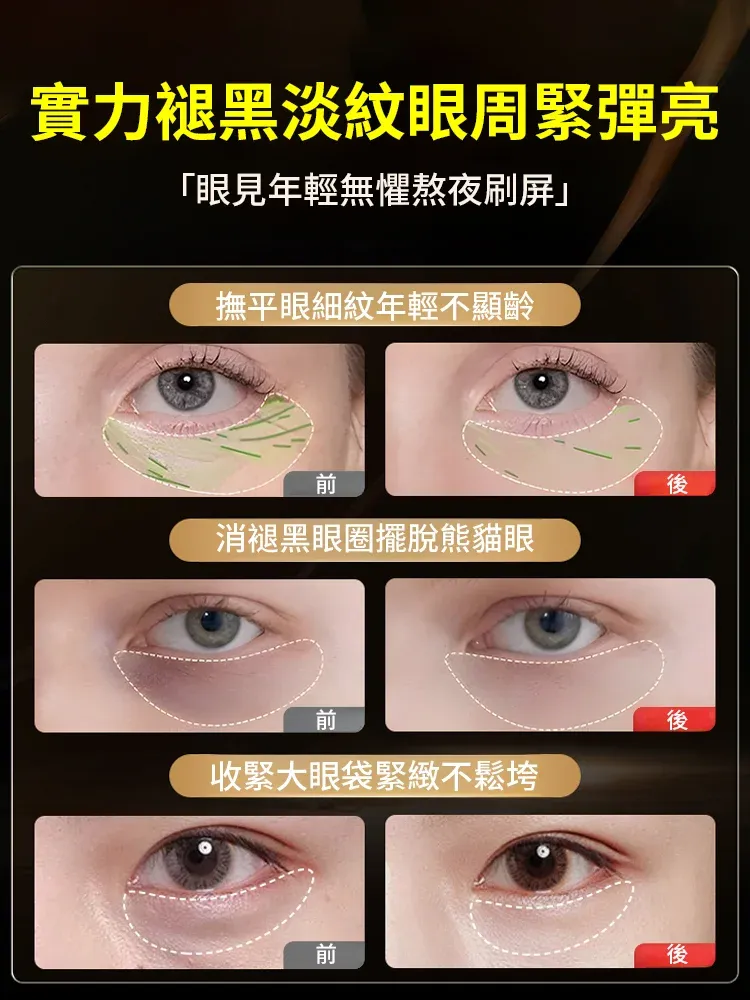 【專攻眼部問題】草本眼袋膏