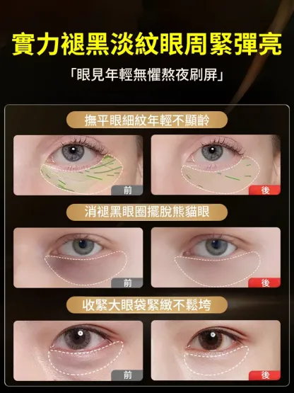 【專攻眼部問題】草本眼袋膏