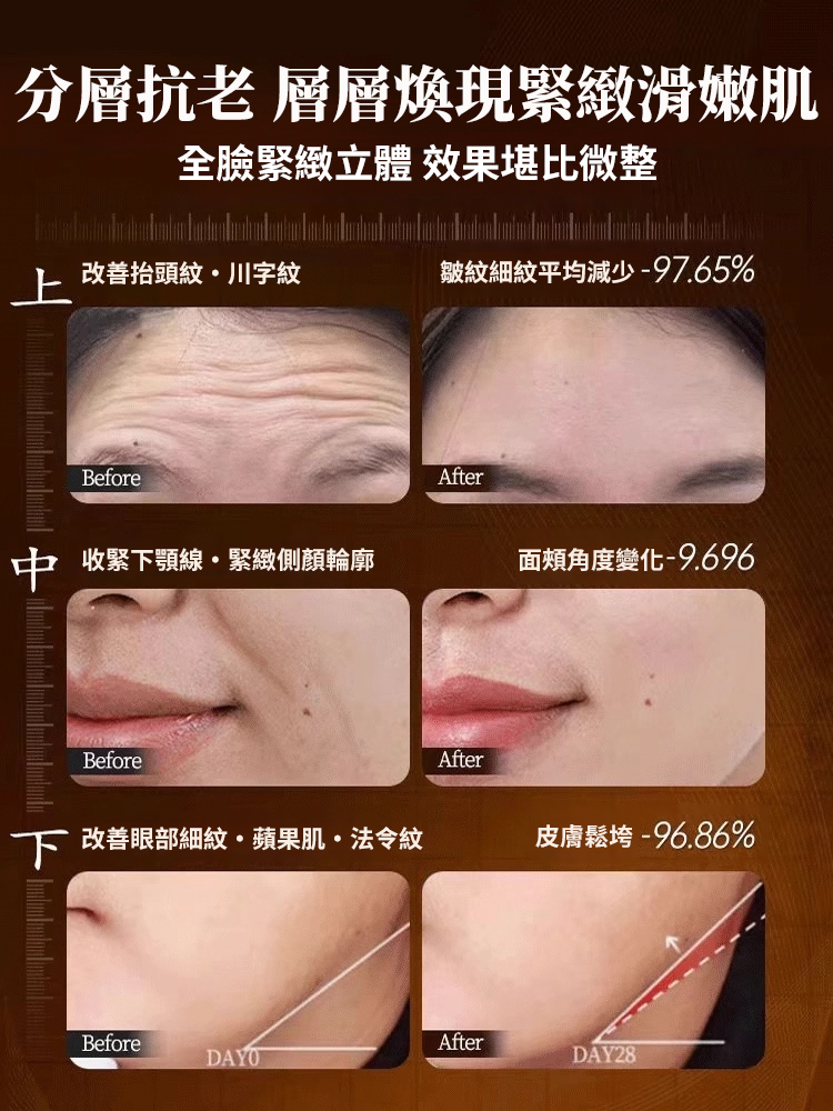 逆齡膠原透明質酸原液