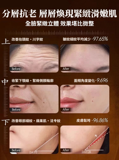 逆齡膠原透明質酸原液