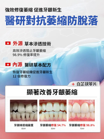 甘草蒲公英白芷茯苓片