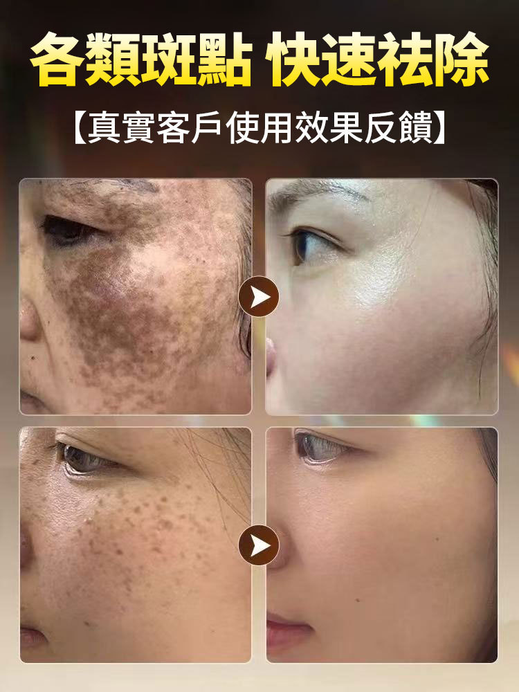 美白淡斑精華液