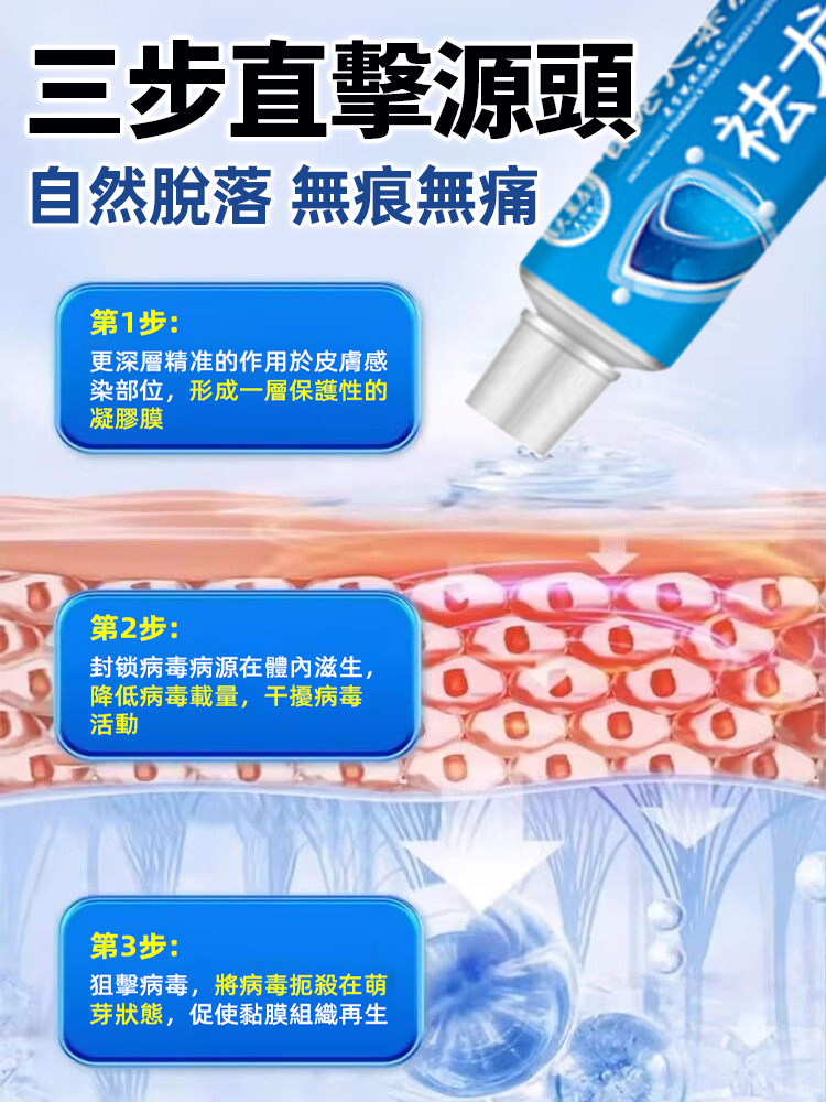 天然草本祛疣型抑菌乳膏
