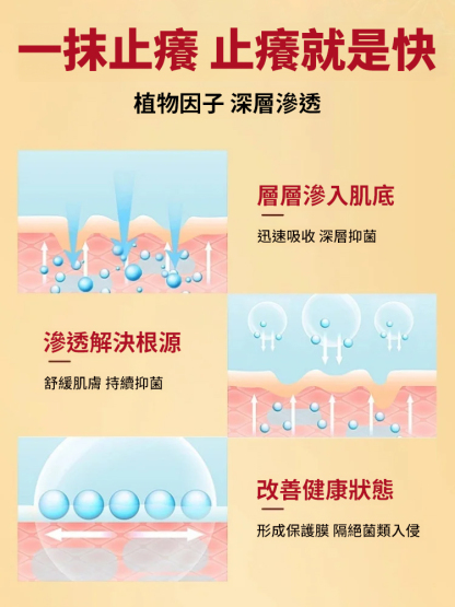 苗族純草本止癢抑菌膏