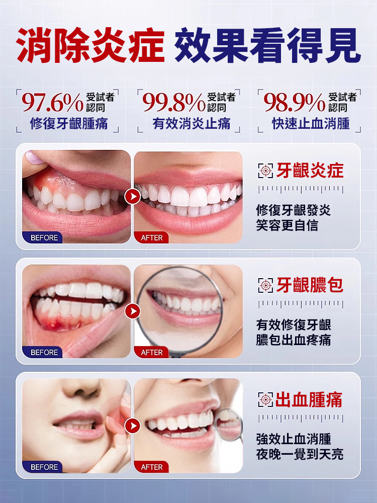禦方草本牙齦康噴劑