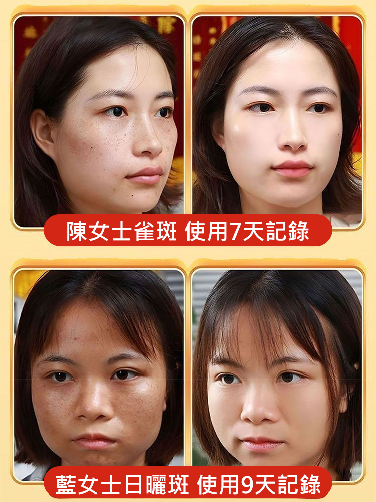 祛斑美白養顏水