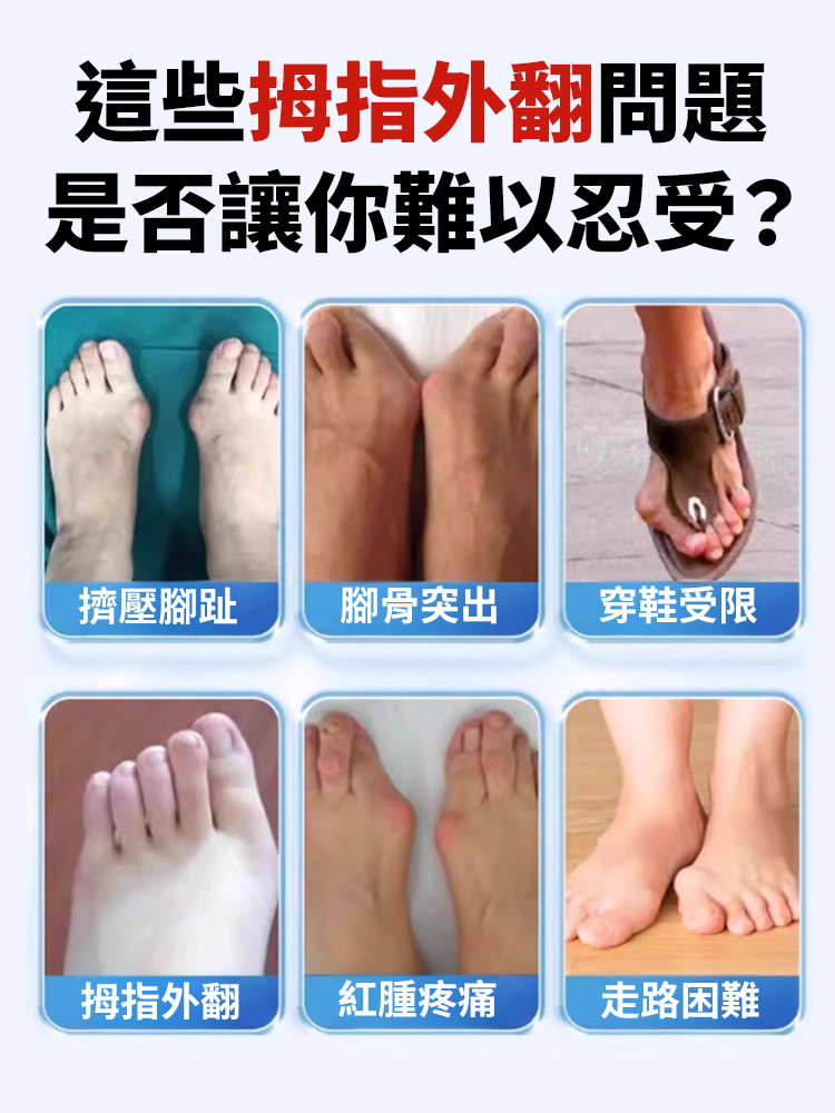 大拇指外翻專用膏