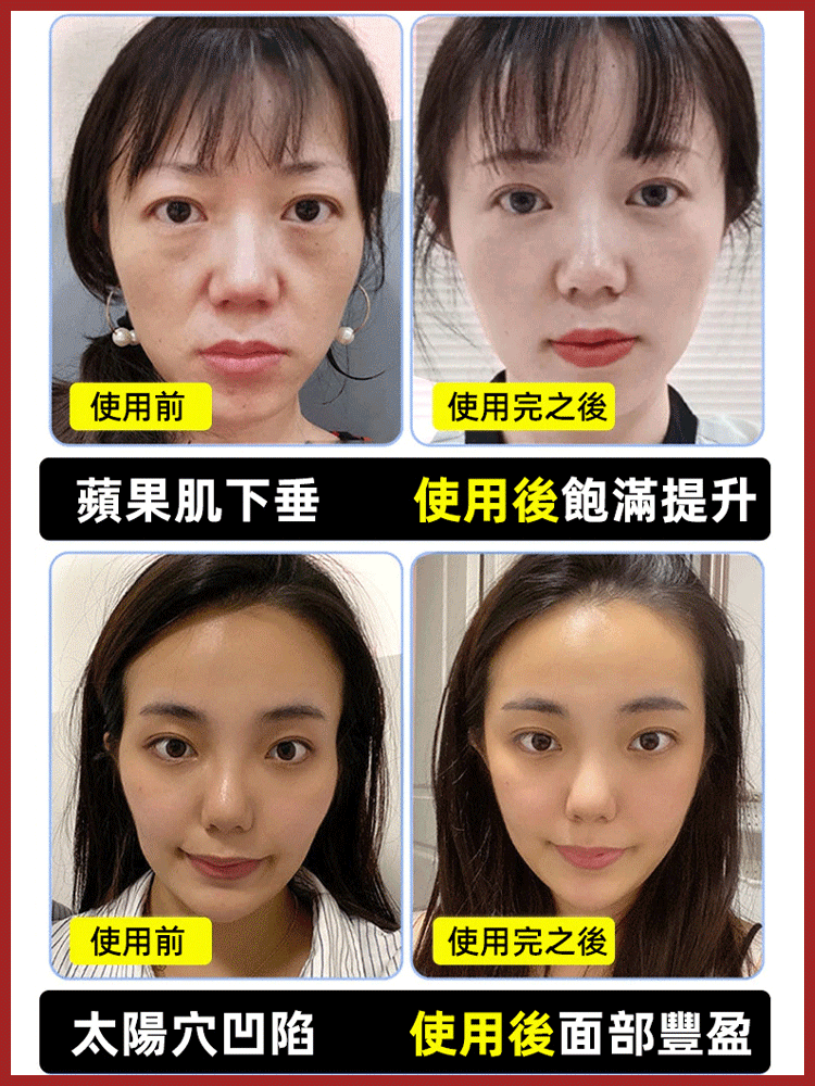 抗皺蛋白溶性緊緻套盒