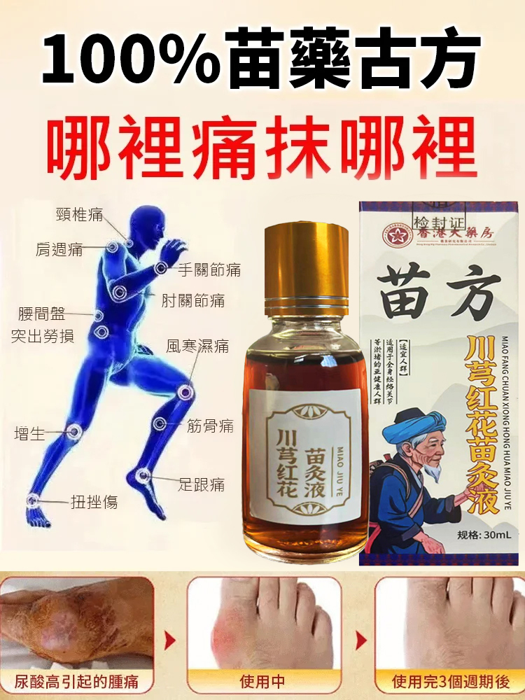 【哪痛塗哪】川穹紅花苗灸液