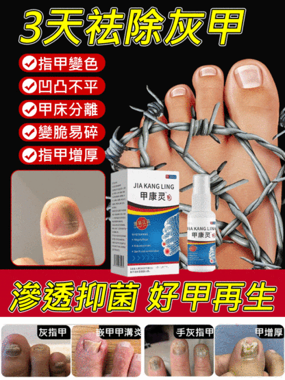 【3天去灰甲】甲康靈