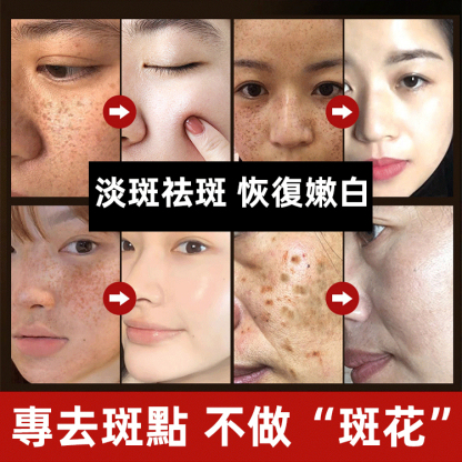 兩週吸走黑斑淡斑抗皺面膜