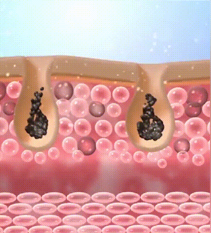 fe55c02f75671162b8231cf9fcc7a84e.gif