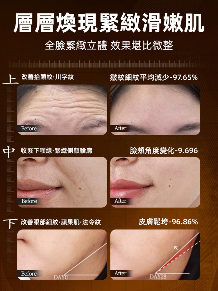 膠原蛋白抗皺精華