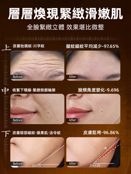 膠原蛋白抗皺精華