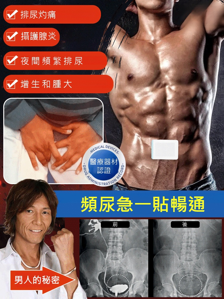 溫和草本前列腺調理穴位貼