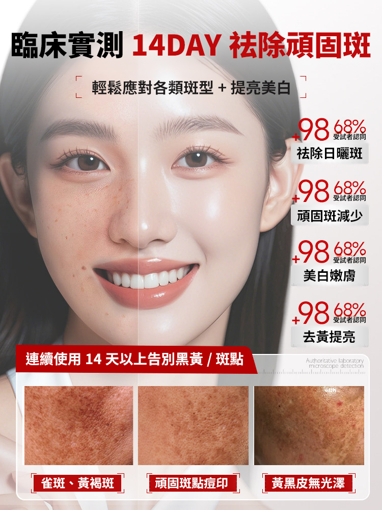 美白祛斑精華霜