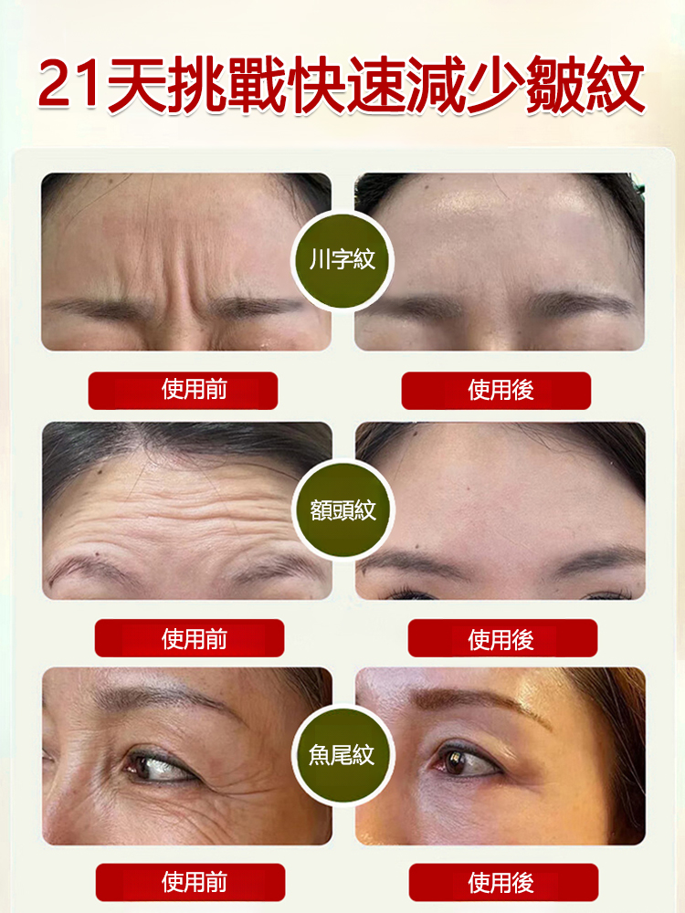 視黃醇蛇毒肽黃金祛皺面膜