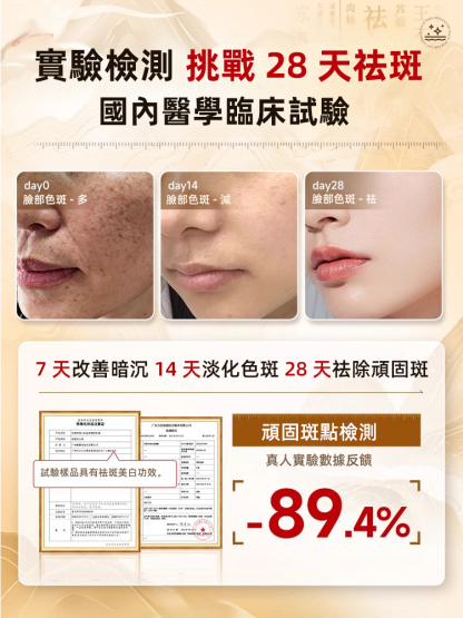 【斑點一抹消】美白祛斑霜