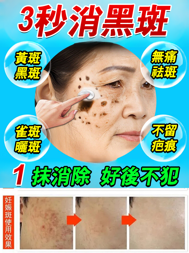 七子美白抗皺精華霜