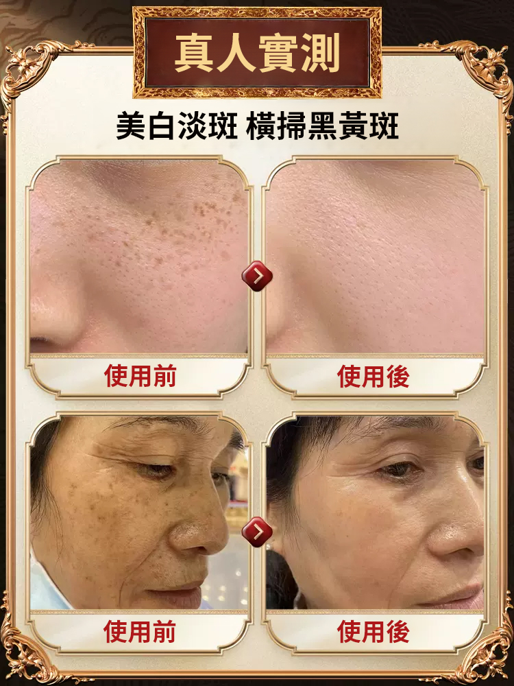 美白強效祛斑霜濃縮版