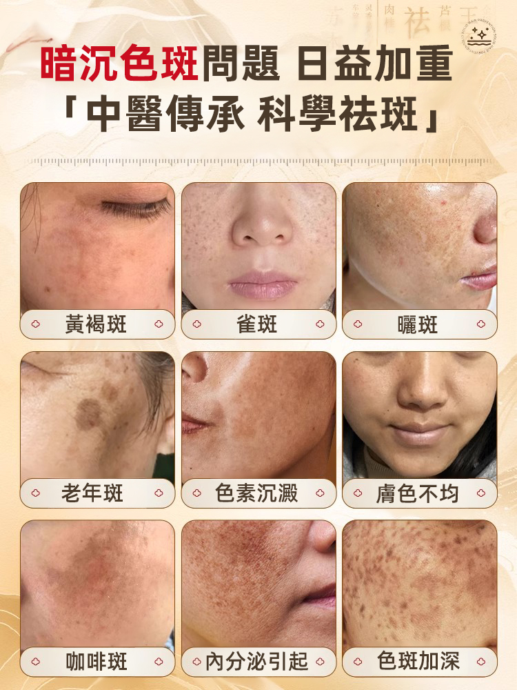 【斑點一抹消】美白祛斑霜