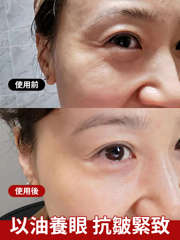 【超強去紋】眼部抗皺按摩精油