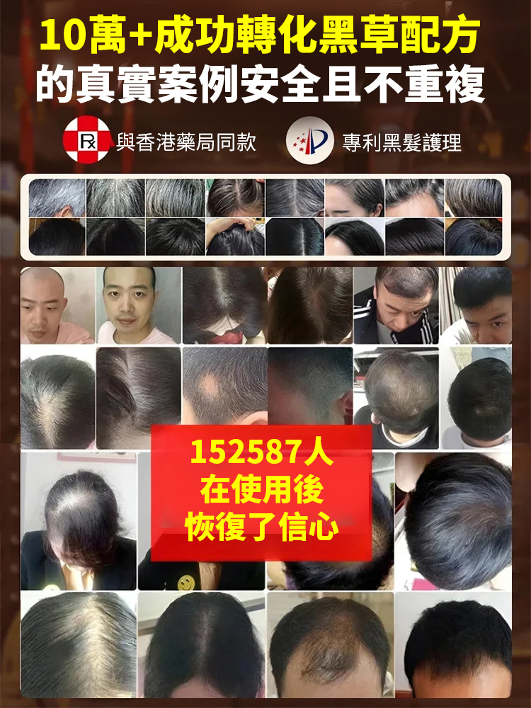 【白髮不再有】烏黑密髮片