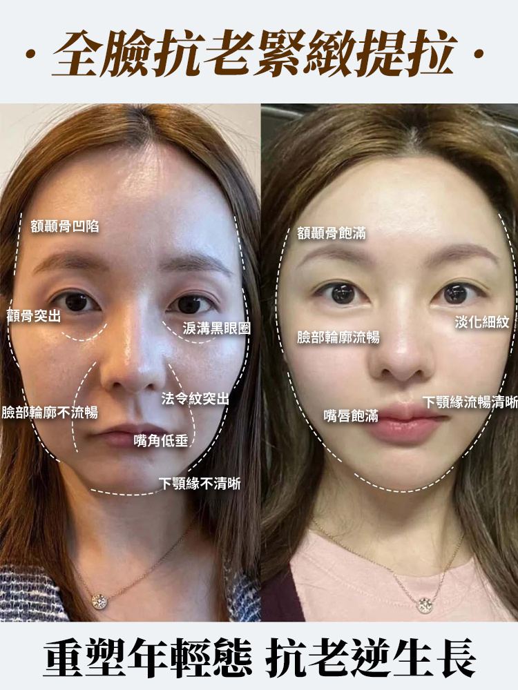 重組膠原抗皺乳霜抗皺淡紋