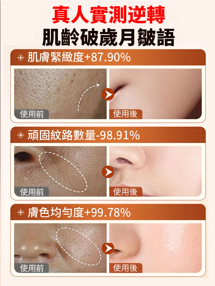 【秒去皺紋】依克多因逆齡精華