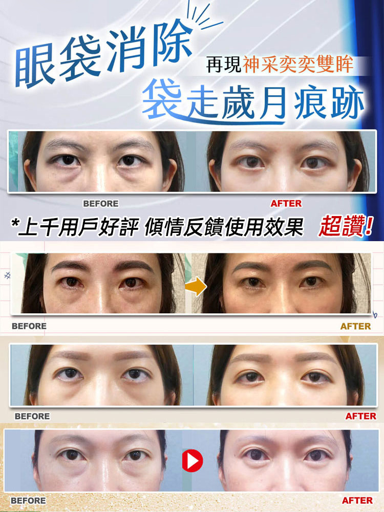 4週消眼袋抗皺扶紋緊緻眼貼