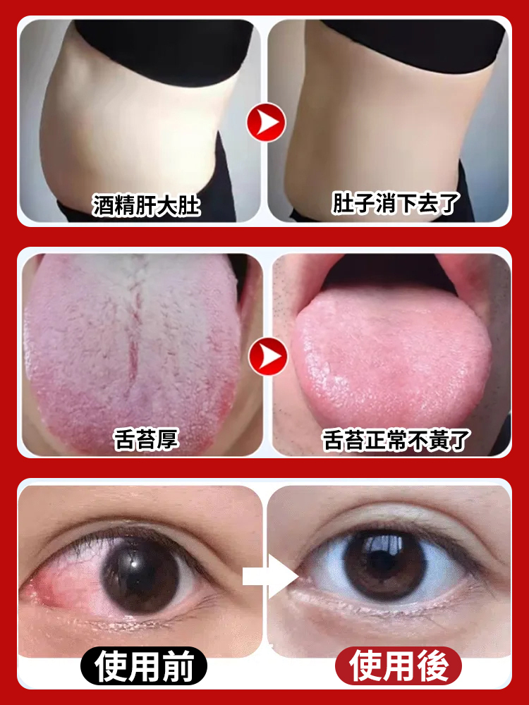 菊花枸杞決明子金銀花蒲公英