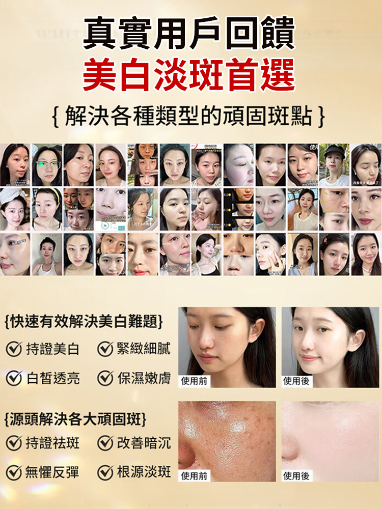 【斑點無蹤】美白祛斑水光精華液