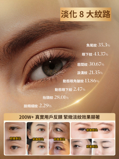 【7天淡紋】眼部抗皺植萃精華油