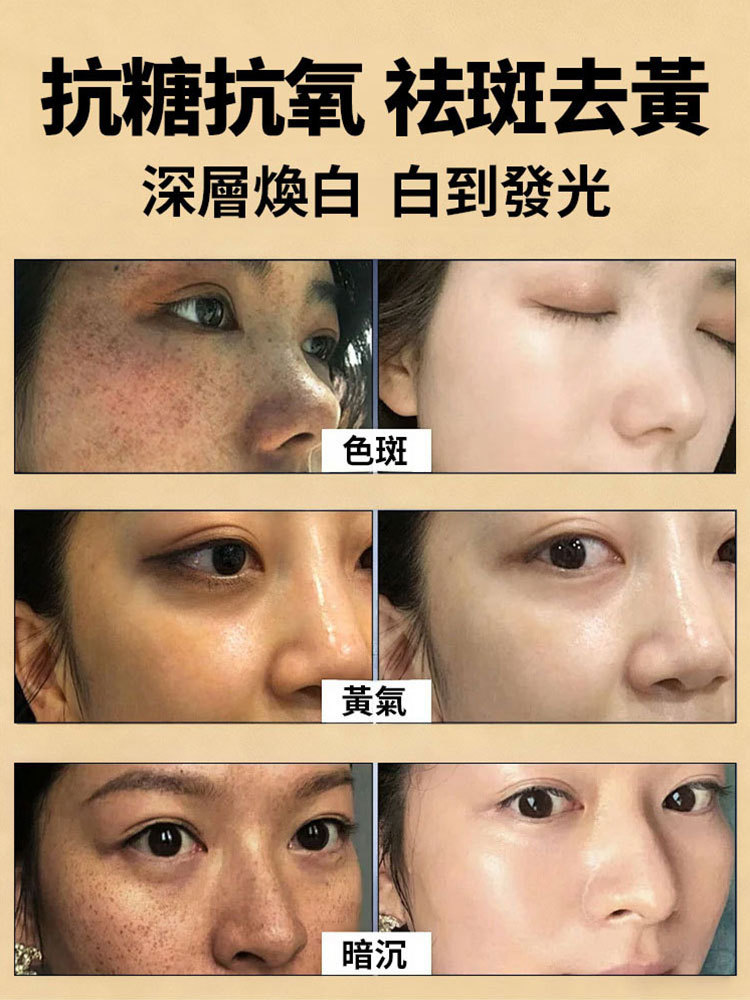 美白祛斑面膜膏