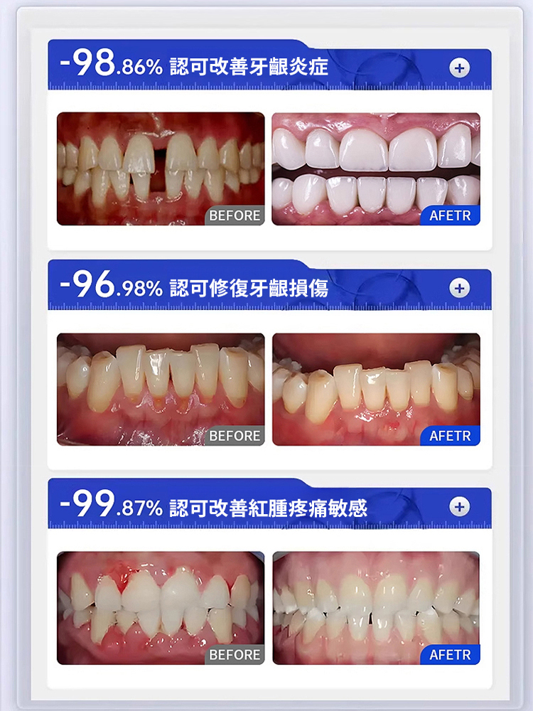 禦方草本牙齦康噴劑