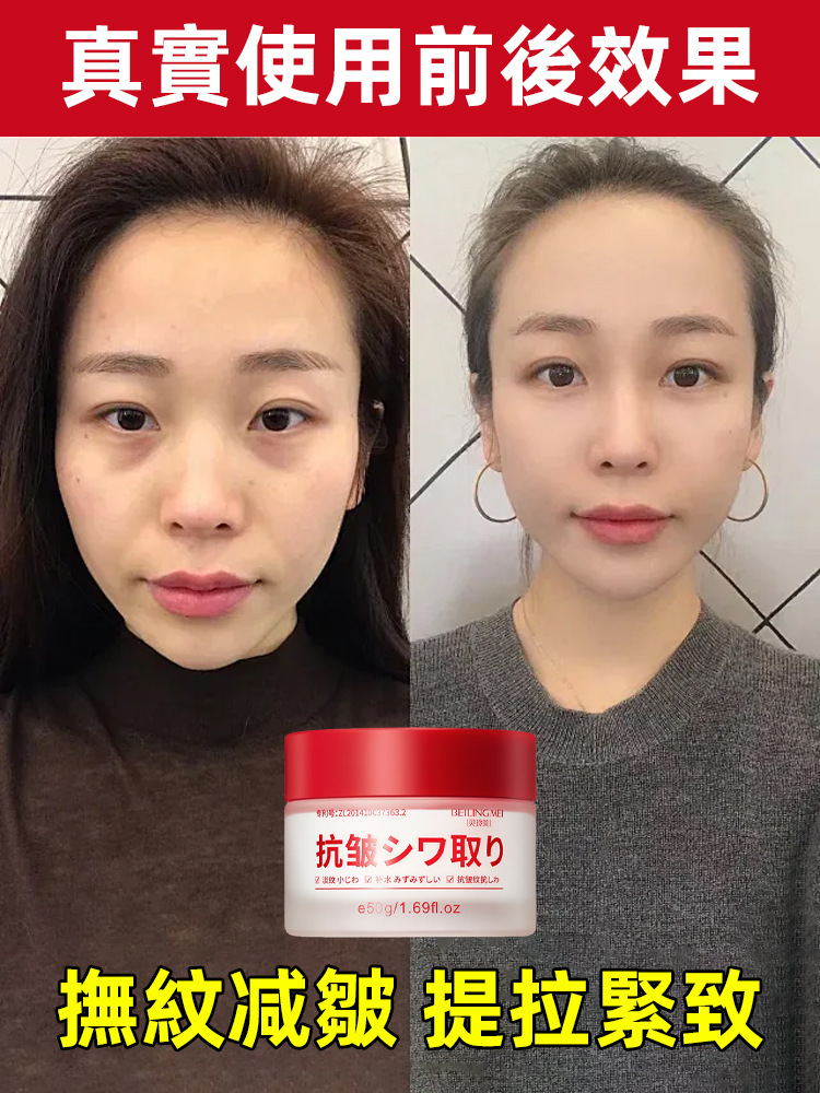 玻色因抗皺淡紋面霜