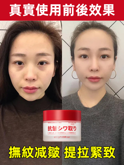 玻色因抗皺淡紋面霜