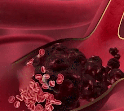 a40a4251d0c016a870e694136d25c32c.gif