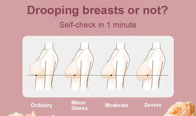 VEIMIA Breast sagging stages self-check