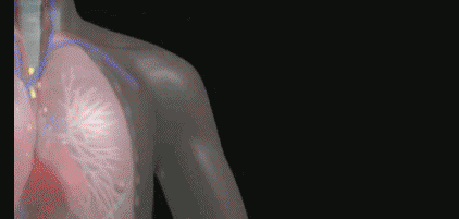 04.gif