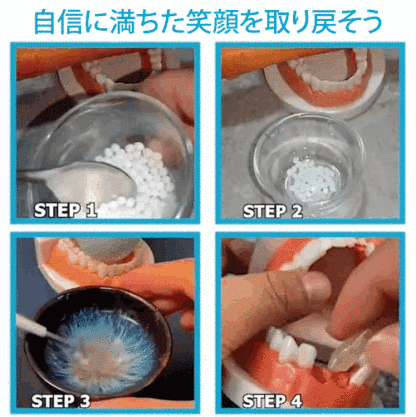 South Moon歯用接着剤