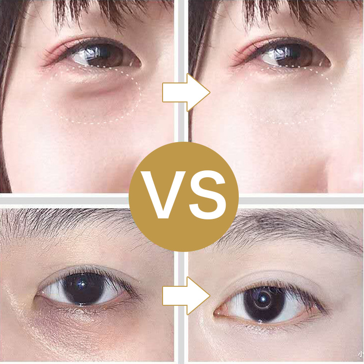 ヘビ毒ペプチド目もとパック