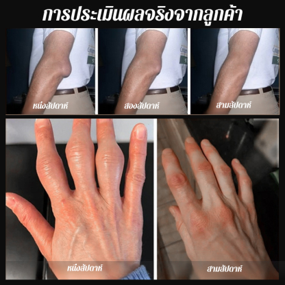 เจลความเจ็บปวดจากการแพทย์